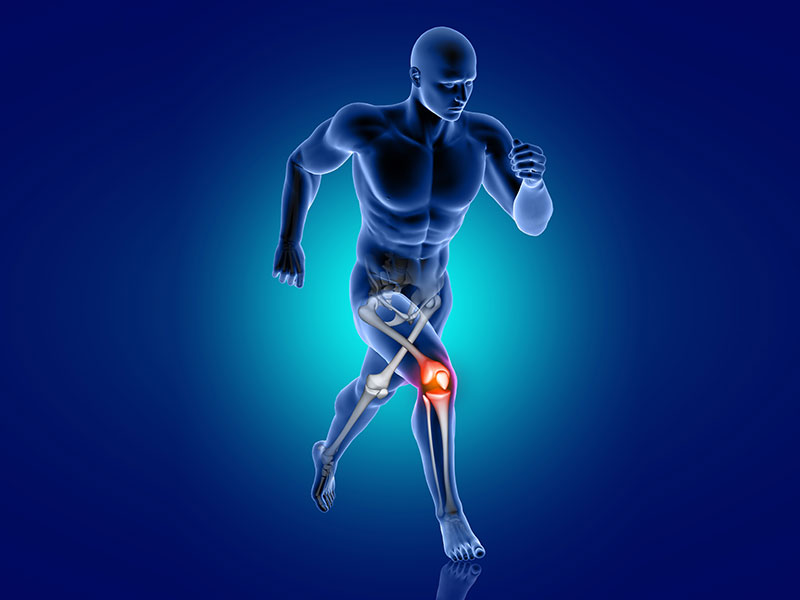 OSTEOARTRİT (OA) SYMPTOMES